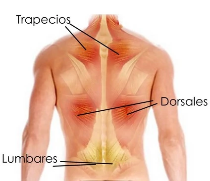 zonas espalda tension muscular